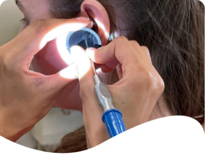 Manual ear wax removal using a specialist tool.